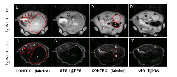 Desarrollan nanopartículas que mejoran el contraste en imágenes de resonancia magnética y facilitan el diagnóstico clínico