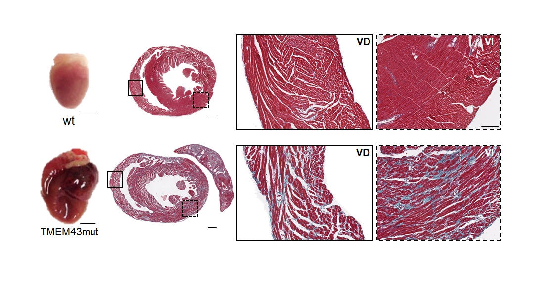 Hallan una terapia para una rara enfermedad cardiaca: la miocardiopatía arritmogénica tipo 5