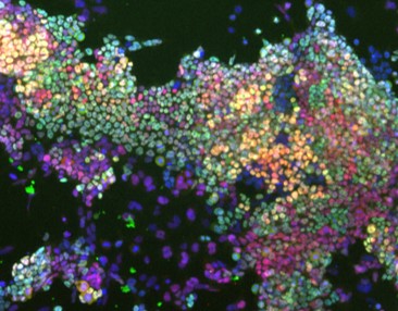 Describen el papel del zinc para mantener la pluripotencia de las células madre embrionarias