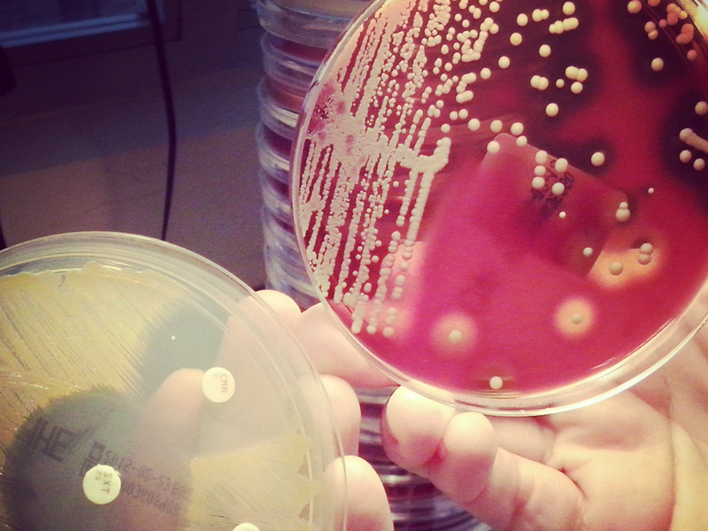 La estrategia de las muñecas rusas para liberar fármacos también es eficaz contra las infecciones causadas por Staphylococcus aureus