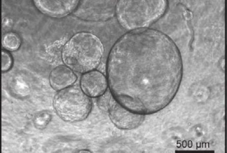 Expanden células madre de hígado adultas a gran escala