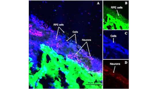 Construyen la primera retina artificial con biomaterial de seda para tratar una degeneración de la mácula
