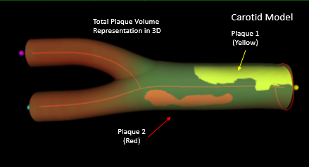 La ecografía vascular en 3D matrix identifica con precisión el daño cardiovascular en personas sanas