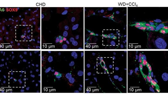 Estudian en células ovales cómo la inhibición del gen Pptn1 protege contra la lipotoxicidad favoreciendo la formación de gotas lipídicas