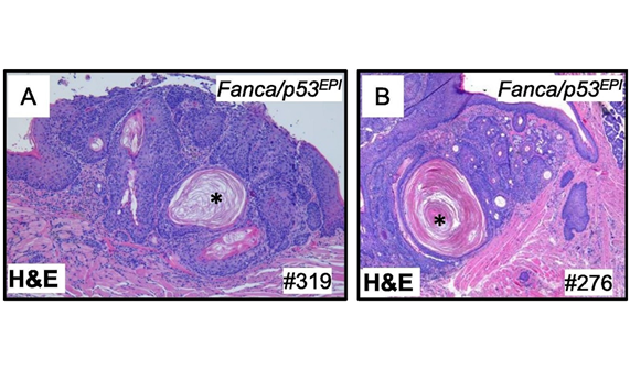 Publican el primer modelo de ratón de carcinomas escamosos de cabeza y cuello en anemia de Fanconi Publican el primer modelo de ratón de carcinomas escamosos de cabeza y cuello en anemia de Fanconi