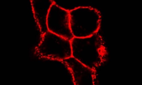 Un nuevo estudio revela que la enzima PADI3 contribuye a la resistencia al tratamiento con neratinib en el cáncer de mama HER2 positivo Un nuevo estudio revela que la enzima PADI3 contribuye a la resistencia al tratamiento con neratinib en el cáncer de mama HER2 positivo