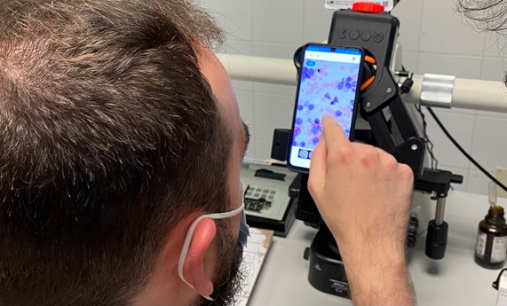 Inteligencia artificial para ayudar a diagnosticar enfermedades hematológicas Inteligencia artificial para ayudar a diagnosticar enfermedades hematológicas