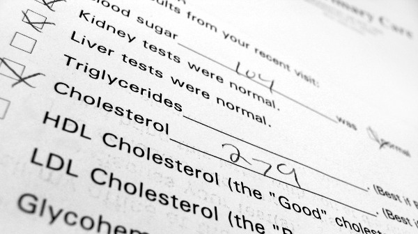 Los niveles de colesterol bueno, claves para atenuar el riesgo cardiovascular