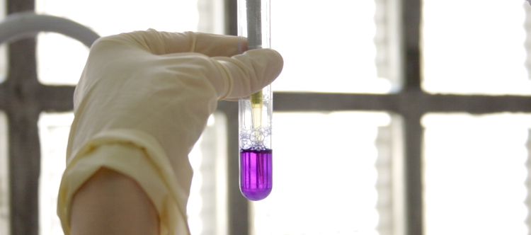 El CIBERER concede ayudas a dos proyectos de investigación traslacional en los que colaboran diversas unidades y grupos clínicos vinculados