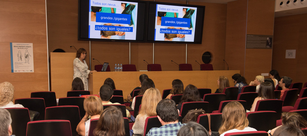 La primera jornada sobre nevus congénito gigante puso de manifiesto la importancia del abordaje multidisciplinar precoz